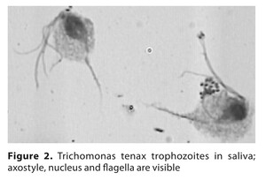 Figure from article: Intraoral  microbiome...