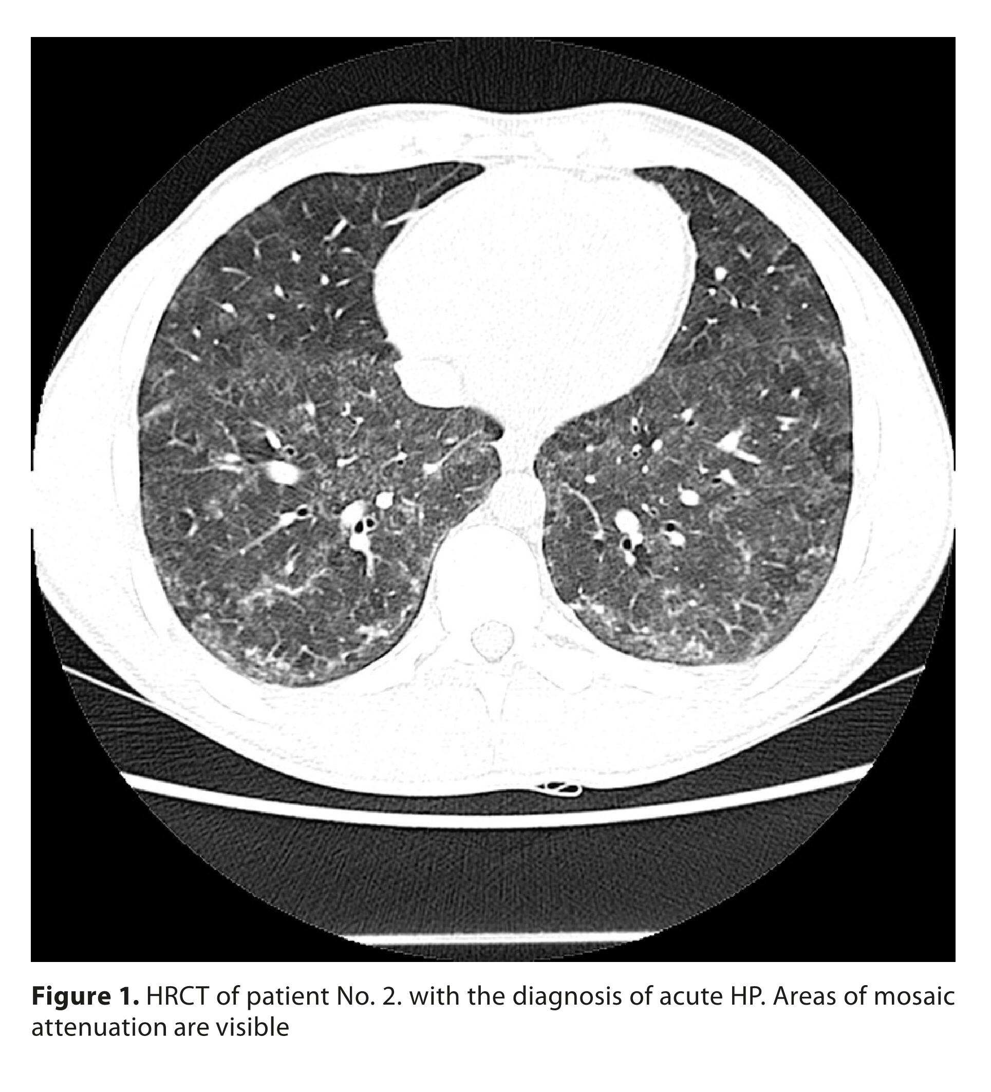 Figure from article: Identification of...